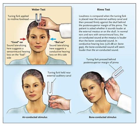 weber test|weber test nursing.